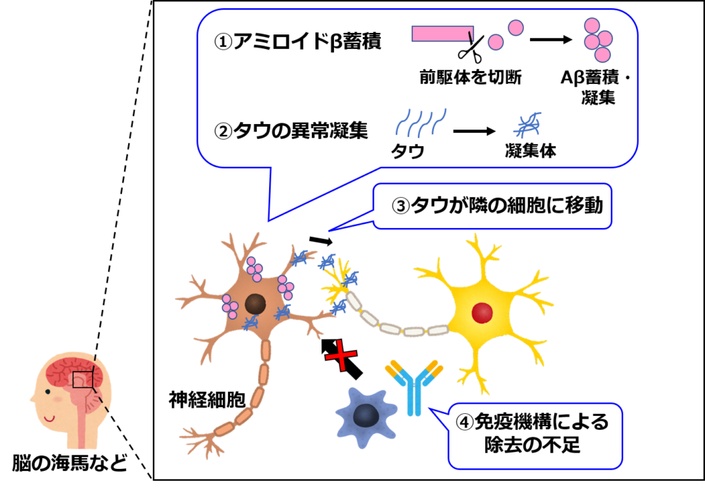 アルツハイマー型認知症の発症メカニズムの概要