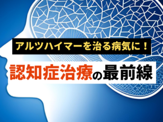 アルツハイマー型認知症治療と検査の最前線