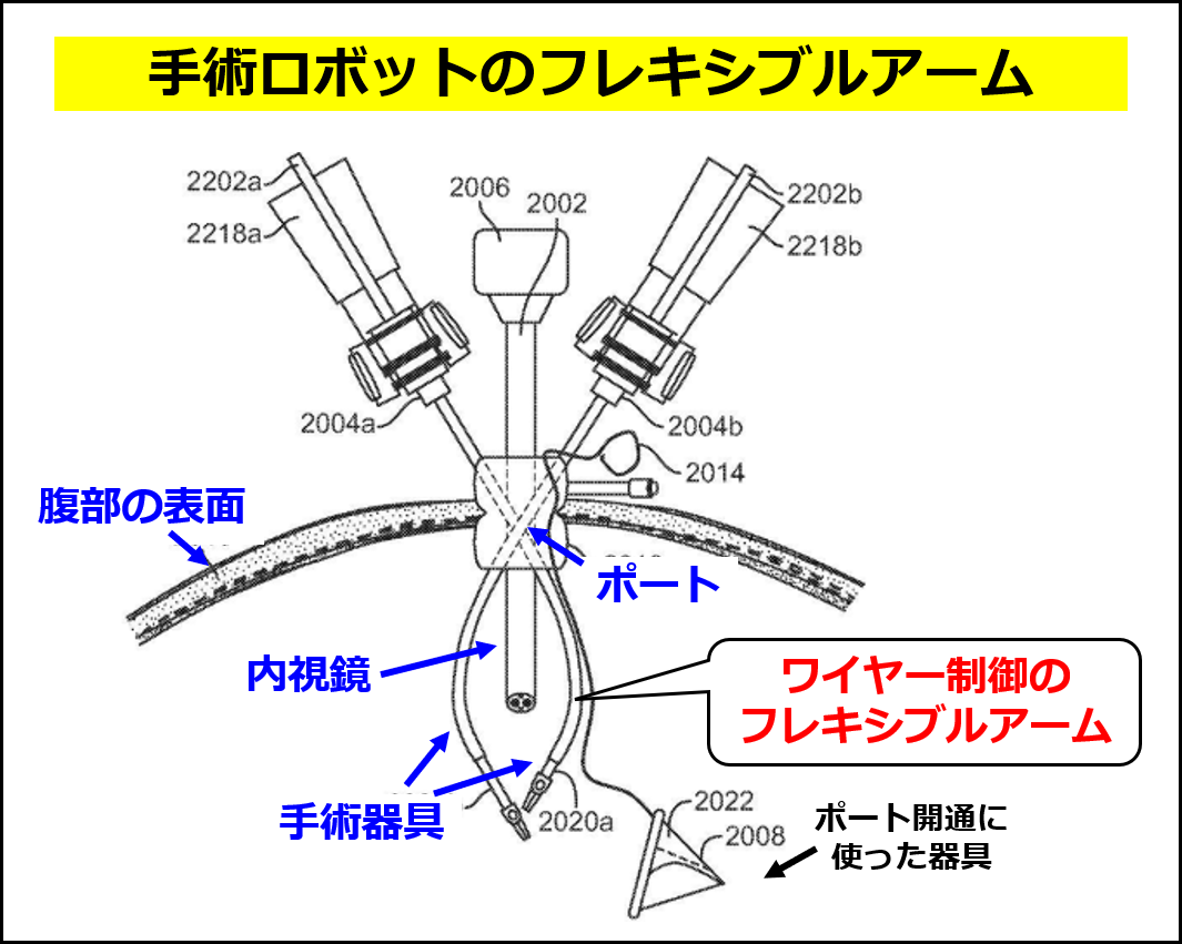 インテュイティブサージカルの手術ロボットに使われるフレキシブルアームのイメージ（同社の特許 JP5833204B2 の図に追記して作成）